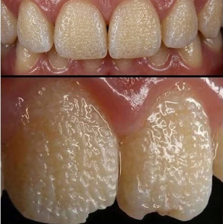 The Hidden Danger Destroying Your Smile That Your Dentist Might Have Missed Until Now