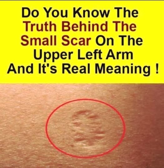 What Smallpox Vaccine Scars Look Like and Why They Appear
