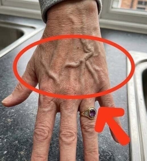 If you have visible veins, it means you are…