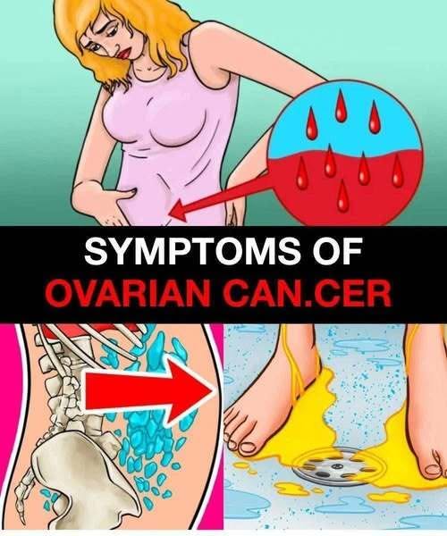 Ovarian Can.cer May Develop Quietly – Here Are the Warning Signs to Watch For