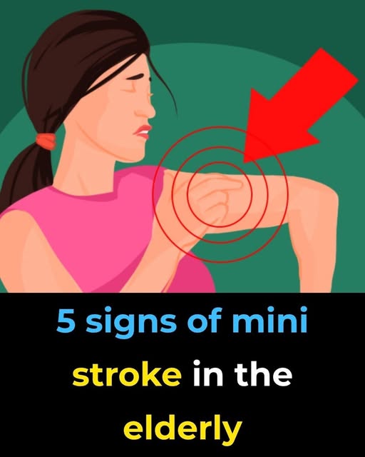 The Silent Killer Hiding in Your Brain: 5 Warning Signs of a Mini Stroke You Are Ignoring at Your Own Peril