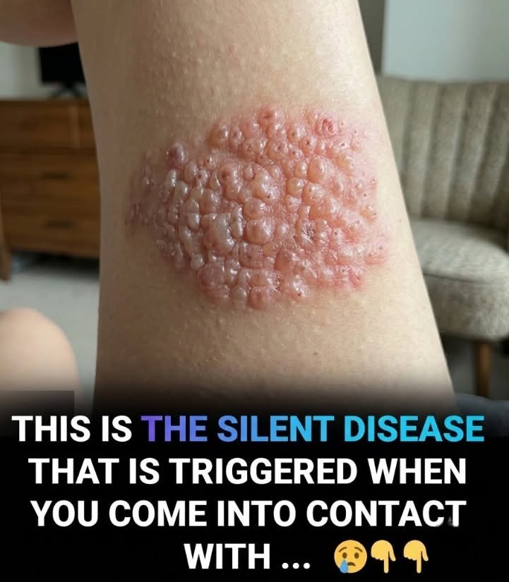 The Sleeping Monster Inside You: Why This Hidden Virus Could Erupt Into Unbearable Agony After Decades of Silence