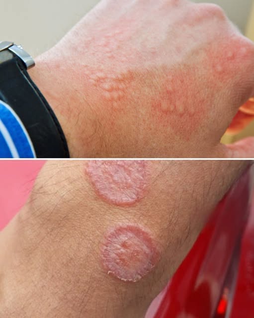 The Hidden Agony: Why Your Groin Irritation Could Be More Than Just a Minor Annoyance