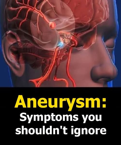 Aneurysm: Doctors misdiagnosed my ruptured brain aneurysm at 37 — the key wa.rning sign they overlooked