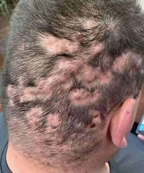 DO NOT IGNORE THE MARK, WHAT THOSE DARK PATCHES ON YOUR SKIN ARE REALLY TRYING TO TELL YOU