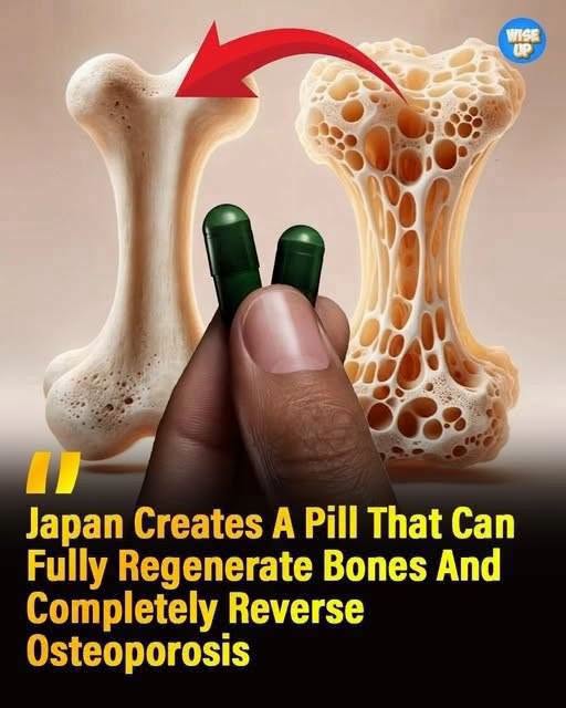 A Daily Pill That Could Rebuild Bone? New Research Offers Hope for Osteoporosis