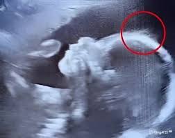 Doctors couldn’t believe what they saw during the ultrasound