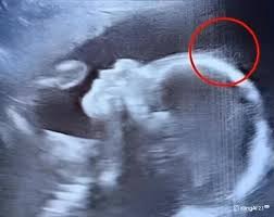 Doctors couldn’t believe what they saw during the ultrasound