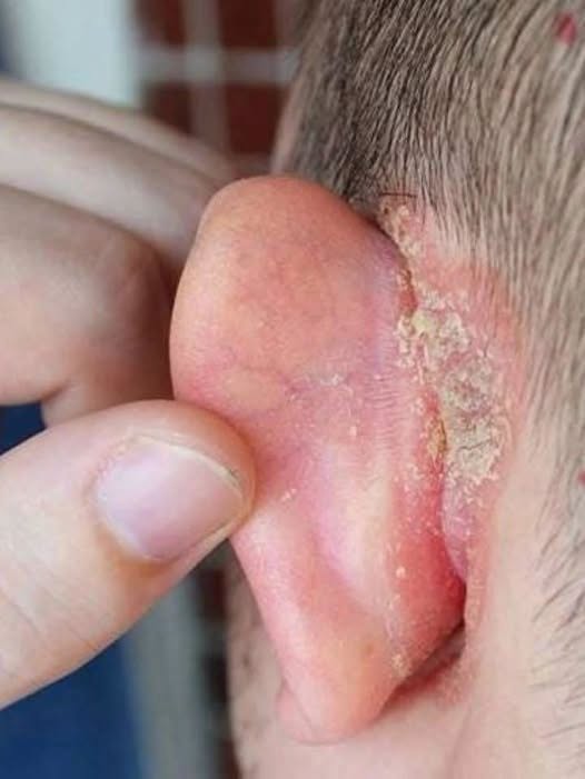 I found a strange patch of skin on my son’s ear this morning. His doctor appointment is a week away — what should I do meanwhile?