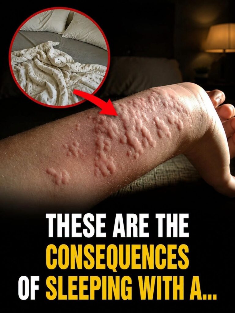 Waking Up Covered in Mysterious Red Bumps? You Could Be Sharing Your Bed with a Nightmare You Can’t See