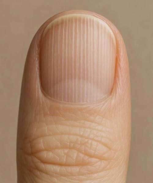 Your Fingernails Are Trying to Warn You of a Hidden Danger, But You’re Ignoring the Most Critical Clues