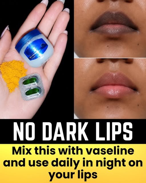 Vaseline Uses and Benefits for Skin, Lips and Hair