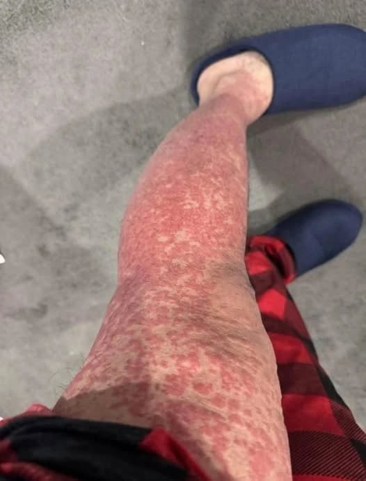 Here are the consequences of sleeping with… See more
