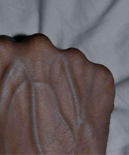 If you have visible veins, it means you are….