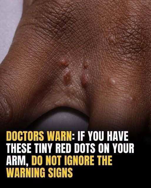 Don’t Ignore These Small Red Bumps—They Could Be Your Body’s Early Warning Signal
