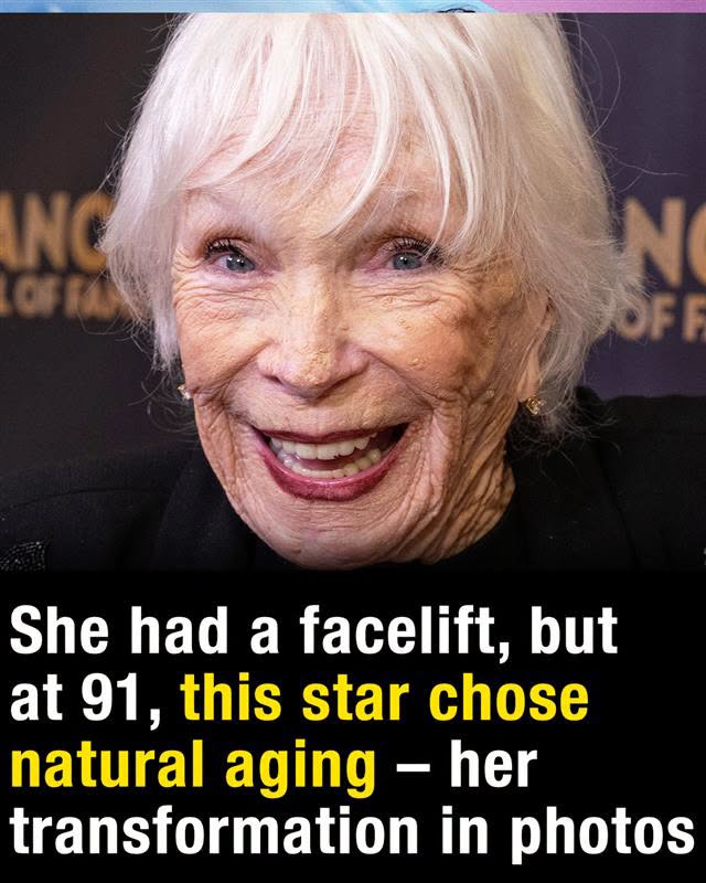 SHIRLEY MACLAINE REVEALS THE TRUTH BEHIND HER 91 YEAR DEFYING TRANSFORMATION AND THE SECRETS OF A HOLLYWOOD LEGEND WHO REFUSES TO FADE AWAY