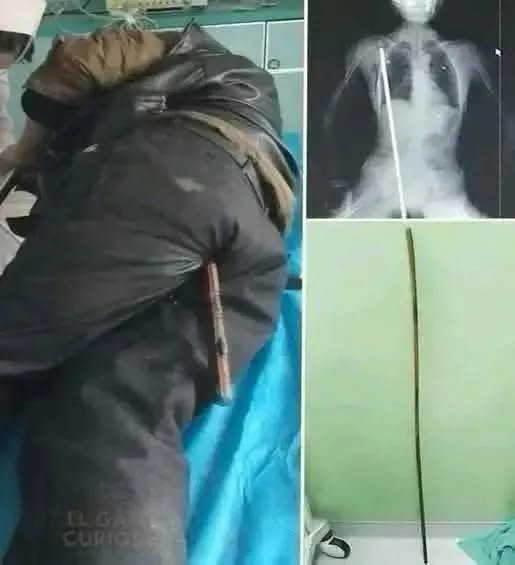 Shocking Police Custody Collapse: Young Man Rushed to Hospital as Outraged Family Demands Answers!