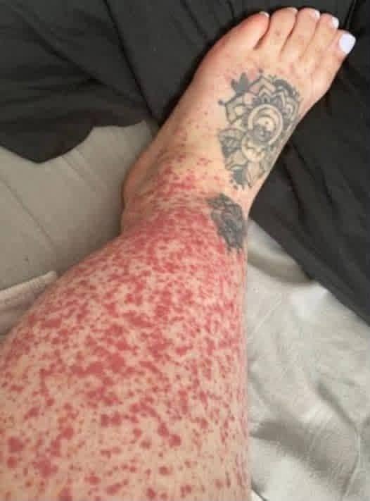 These are the consequences of sleeping with the…See more