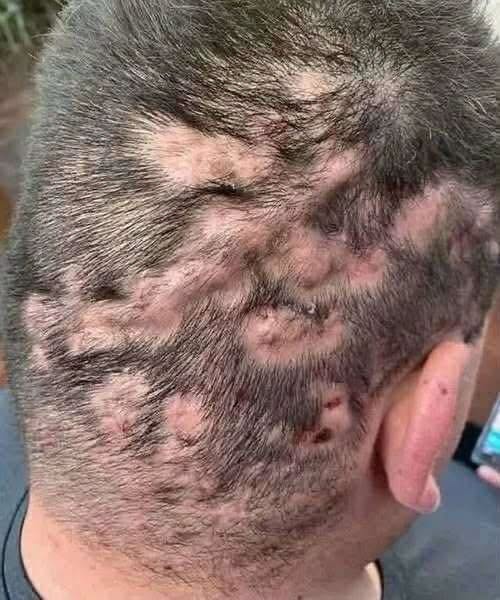 DO NOT IGNORE THE MARK, WHAT THOSE DARK PATCHES ON YOUR SKIN ARE REALLY TRYING TO TELL YOU